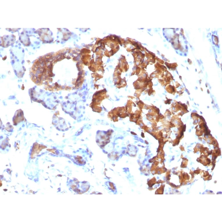 Immunohistochemistry - Anti-TNF alpha Antibody [TNFA/1172] (A251069) - Antibodies.com