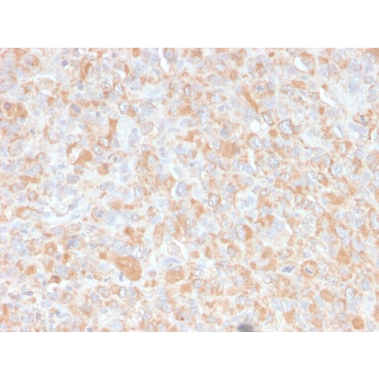 Immunohistochemistry - Anti-TNF alpha Antibody [4C6-H8] (A251070) - Antibodies.com