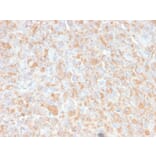 Immunohistochemistry - Anti-TNF alpha Antibody [4C6-H8] (A251070) - Antibodies.com