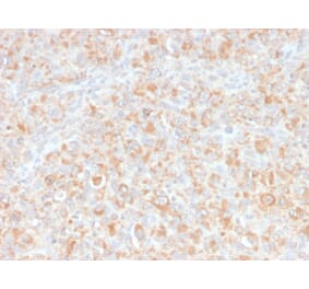 Immunohistochemistry - Anti-TNF alpha Antibody [SPM543] (A251071) - Antibodies.com
