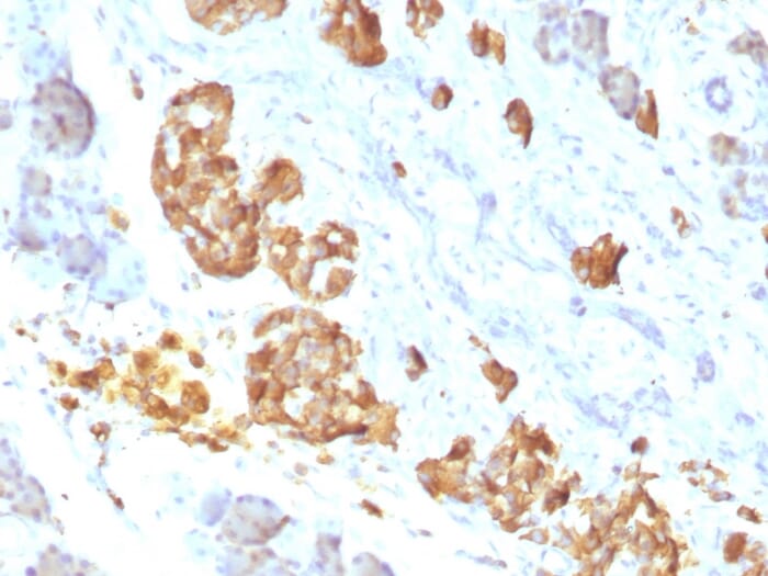 Anti-TNF alpha Antibody [P/T2] (A251072) | Antibodies.com