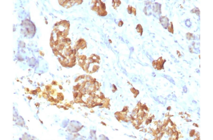Immunohistochemistry - Anti-TNF alpha Antibody [P/T2] (A251072) - Antibodies.com