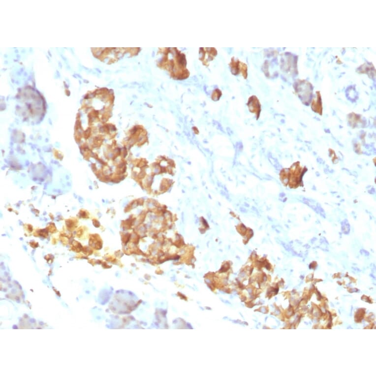 Immunohistochemistry - Anti-TNF alpha Antibody [P/T2] (A251072) - Antibodies.com