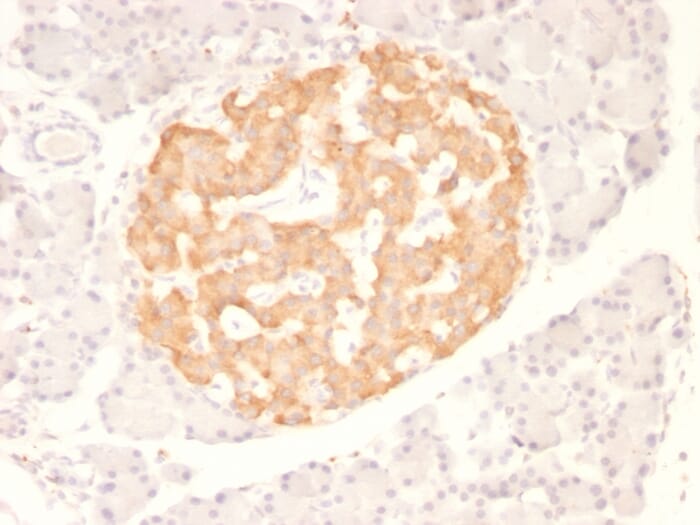 Anti-TNF alpha Antibody [TNF706] (A251073) | Antibodies.com