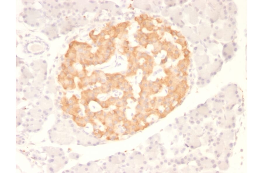 Immunohistochemistry - Anti-TNF alpha Antibody [TNF706] (A251073) - Antibodies.com