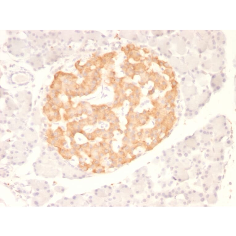 Immunohistochemistry - Anti-TNF alpha Antibody [TNF706] (A251073) - Antibodies.com