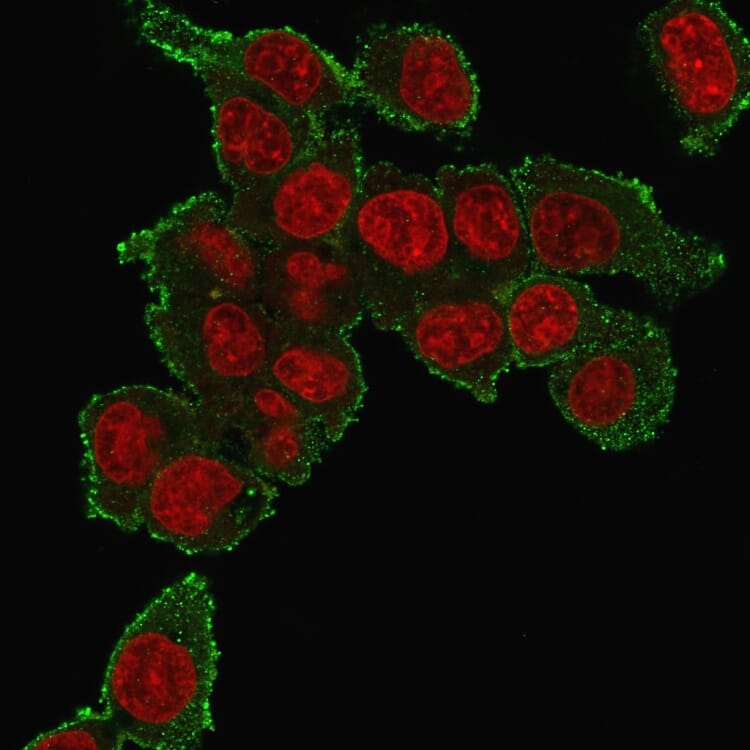 Anti-TNF alpha Antibody [TNF706] (A251073) | Antibodies.com