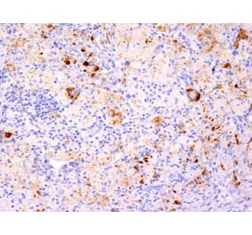 Immunohistochemistry - Anti-TNF alpha Antibody [TNF706 + P/T2] (A251073) - Antibodies.com