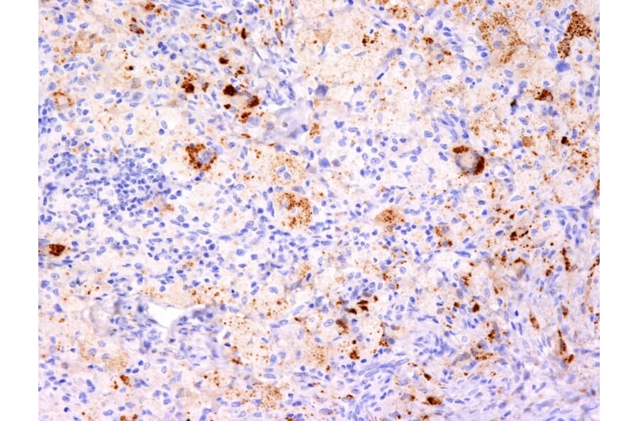 Immunohistochemistry - Anti-TNF alpha Antibody [TNF706 + P/T2] (A251073) - Antibodies.com