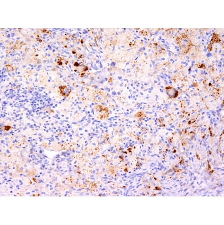 Immunohistochemistry - Anti-TNF alpha Antibody [TNF706 + P/T2] (A251073) - Antibodies.com