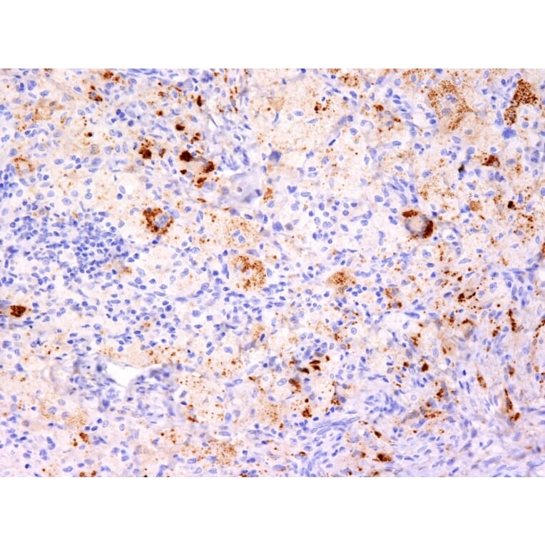 Immunohistochemistry - Anti-TNF alpha Antibody [TNF706 + P/T2] (A251073) - Antibodies.com