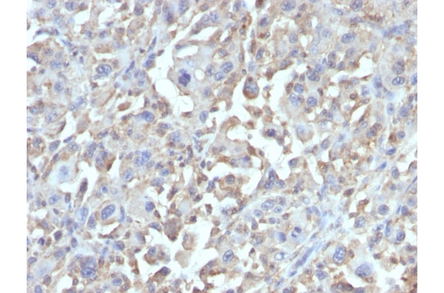 Immunohistochemistry - Anti-TNF alpha Antibody [MAb1] (A251074) - Antibodies.com