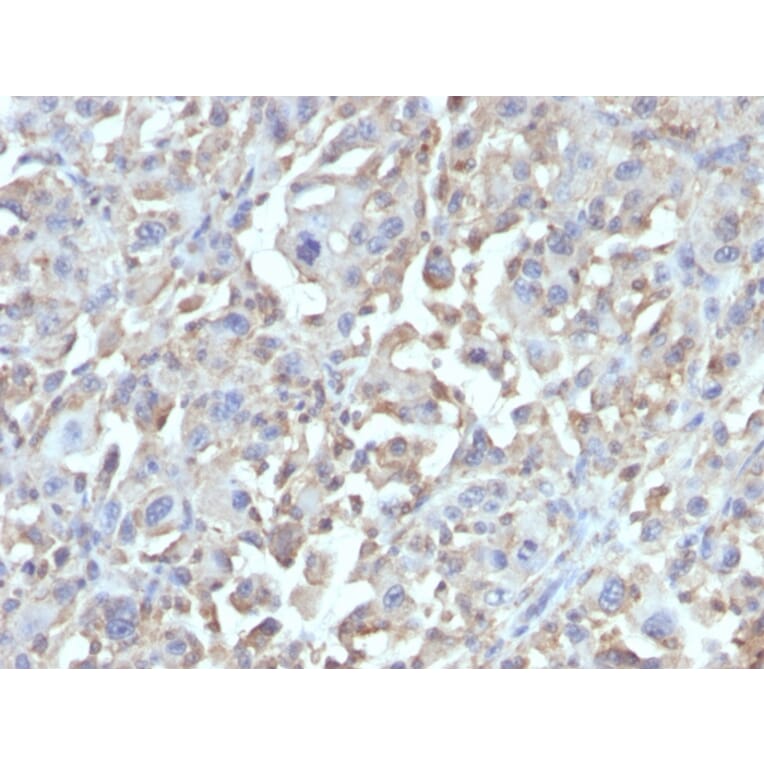 Immunohistochemistry - Anti-TNF alpha Antibody [MAb1] (A251074) - Antibodies.com