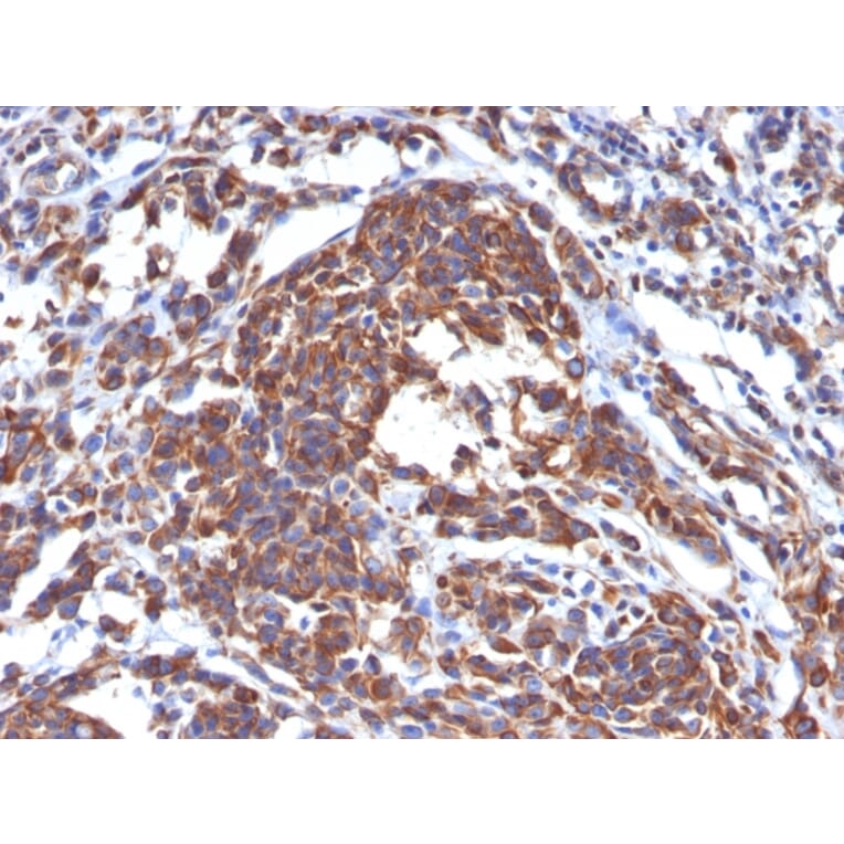 Immunohistochemistry - Anti-Vimentin Antibody [LN-6] (A251075) - Antibodies.com