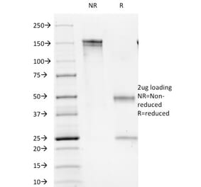 SDS-PAGE - Anti-CD1b Antibody [100-1A5] (A251076) - Antibodies.com