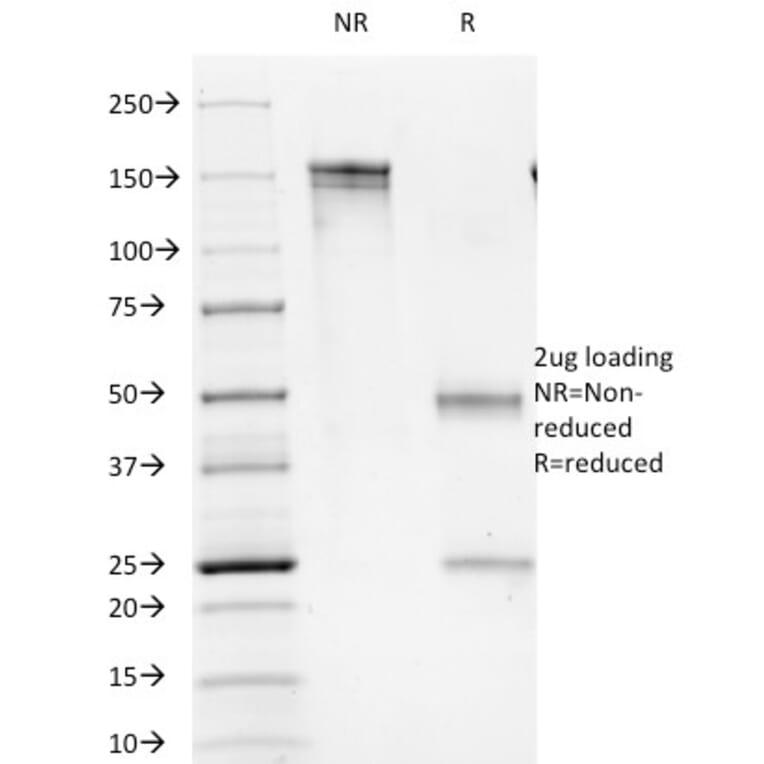 SDS-PAGE - Anti-CD1b Antibody [100-1A5] (A251076) - Antibodies.com