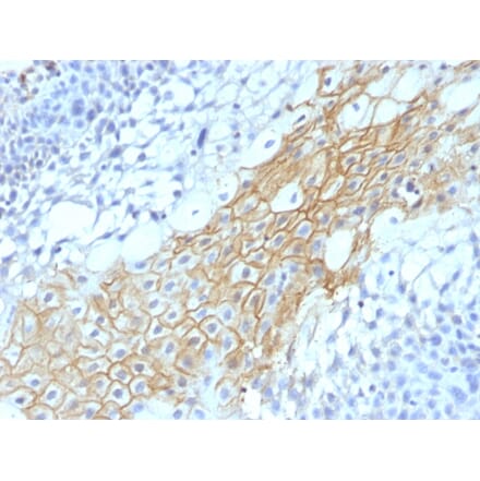 Immunohistochemistry - Anti-CD59 Antibody [MACIF/1193] (A251079) - Antibodies.com