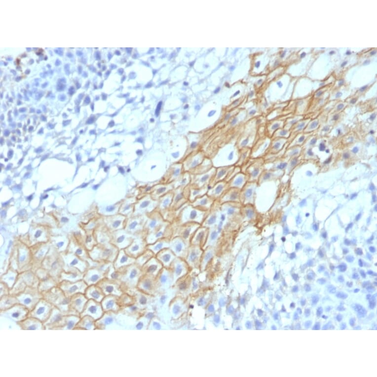 Immunohistochemistry - Anti-CD59 Antibody [MACIF/1193] (A251079) - Antibodies.com