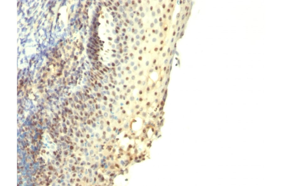 Immunohistochemistry - Anti-IPO-38 Antibody [IPO-38] (A251088) - Antibodies.com