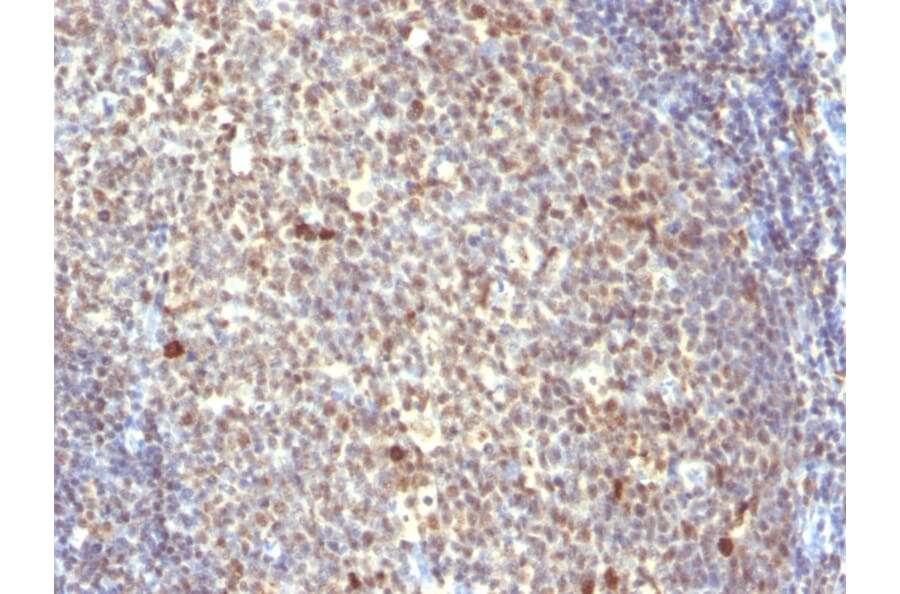 Immunohistochemistry - Anti-IPO-38 Antibody [IPO-38] (A252268) - Antibodies.com