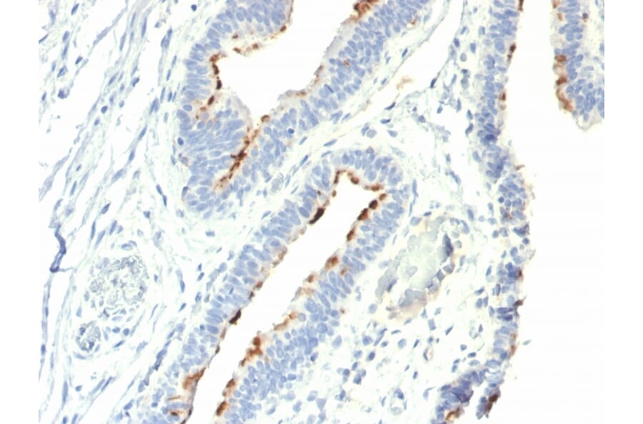 Immunohistochemistry - Anti-Thomsen-Friedenreich Antigen Antibody [A78-G/A7] (A251088) - Antibodies.com