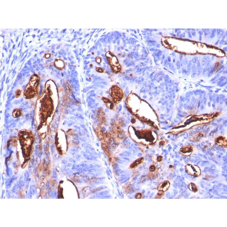 Immunohistochemistry - Anti-CA19-9 Antibody [SPM588] (A251089) - Antibodies.com