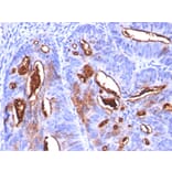 Immunohistochemistry - Anti-CA19-9 Antibody [SPM588] (A251089) - Antibodies.com