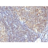 Immunohistochemistry - Anti-IPO-38 Antibody [SPM260] (A251090) - Antibodies.com