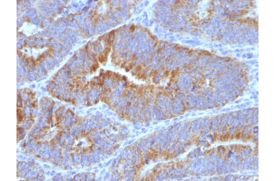 Immunohistochemistry - Anti-Thomsen-Friedenreich Antigen Antibody [SPM320] (A251091) - Antibodies.com