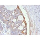Immunohistochemistry - Anti-Thomsen-Friedenreich Antigen Antibody [A63-C/A9] (A251097) - Antibodies.com