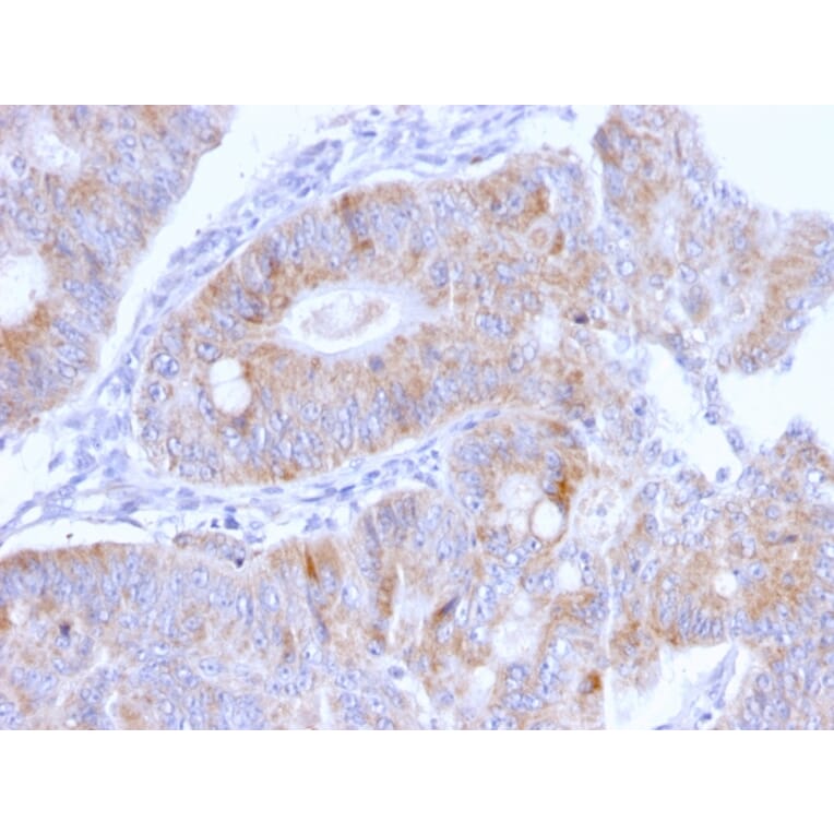 Immunohistochemistry - Anti-Thomsen-Friedenreich Antigen Antibody [A63-C/A9] (A251093) - Antibodies.com