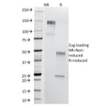 SDS-PAGE - Anti-Thomsen-Friedenreich Antigen Antibody [A84-A/F10] (A251098) - Antibodies.com