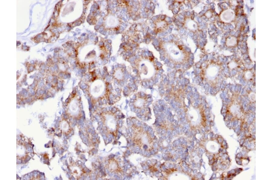 Immunohistochemistry - Anti-Thomsen-Friedenreich Antigen Antibody [A84-A/F10] (A251098) - Antibodies.com