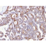 Immunohistochemistry - Anti-Thomsen-Friedenreich Antigen Antibody [A84-A/F10] (A251098) - Antibodies.com