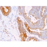Immunohistochemistry - Anti-Thomsen-Friedenreich Antigen Antibody [A84-A/F10] (A251097) - Antibodies.com