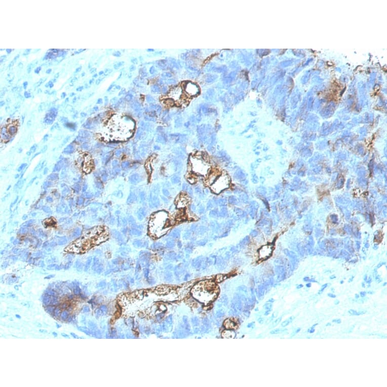 Immunohistochemistry - Anti-Carcinoembryonic Antigen Antibody [C66/1030] (Biotin) (A251122) - Antibodies.com