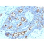 Immunohistochemistry - Anti-Carcinoembryonic Antigen Antibody [C66/1030] (Biotin) (A251122) - Antibodies.com