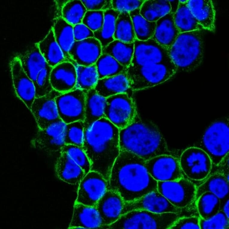 Immunofluorescence - Anti-EGFR Antibody [GFR450] (CF® 488) (A251126) - Antibodies.com