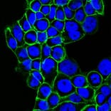 Immunofluorescence - Anti-EGFR Antibody [GFR450] (CF® 488) (A251126) - Antibodies.com