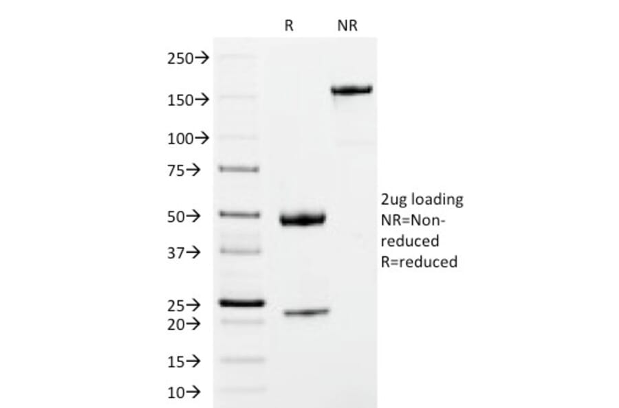 SDS-PAGE - Anti-Human IgM Heavy Chain Antibody [IM373] (CF® 488) (A252140) - Antibodies.com