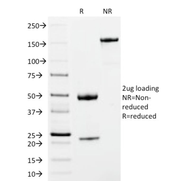 SDS-PAGE - Anti-Human IgM Heavy Chain Antibody [IM373] (CF® 488) (A252140) - Antibodies.com