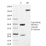 SDS-PAGE - Anti-Human IgM Heavy Chain Antibody [IM373] (CF® 488) (A252140) - Antibodies.com