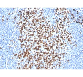 Immunohistochemistry - Anti-Ki67 Antibody [MKI67/2465] (Biotin) (A251138) - Antibodies.com