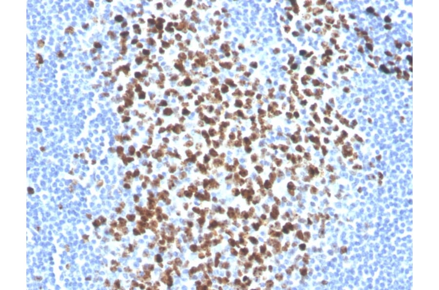 Immunohistochemistry - Anti-Ki67 Antibody [MKI67/2465] (Biotin) (A251138) - Antibodies.com