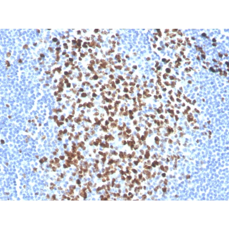 Immunohistochemistry - Anti-Ki67 Antibody [MKI67/2465] (Biotin) (A251138) - Antibodies.com