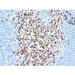 Immunohistochemistry - Anti-Ki67 Antibody [MKI67/2465] (Biotin) (A251138) - Antibodies.com