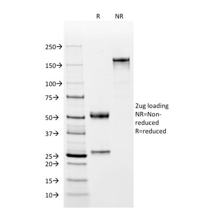 SDS-PAGE - Anti-C4d Antibody [C4D204] (CF® 488) (A251154) - Antibodies.com
