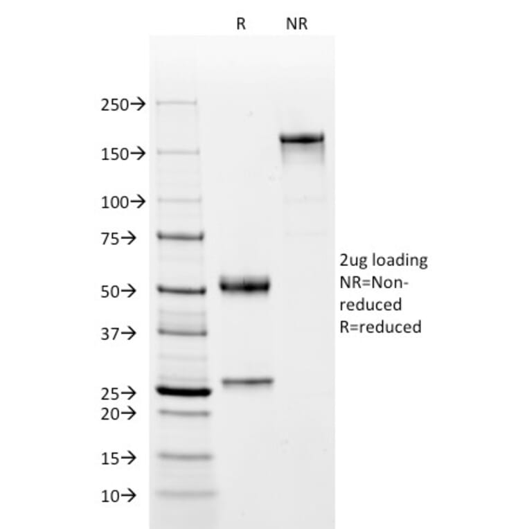 SDS-PAGE - Anti-C4d Antibody [C4D204] (CF® 488) (A251154) - Antibodies.com