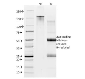 SDS-PAGE - Anti-CD28 Antibody [CB28] (PE) (A251156) - Antibodies.com