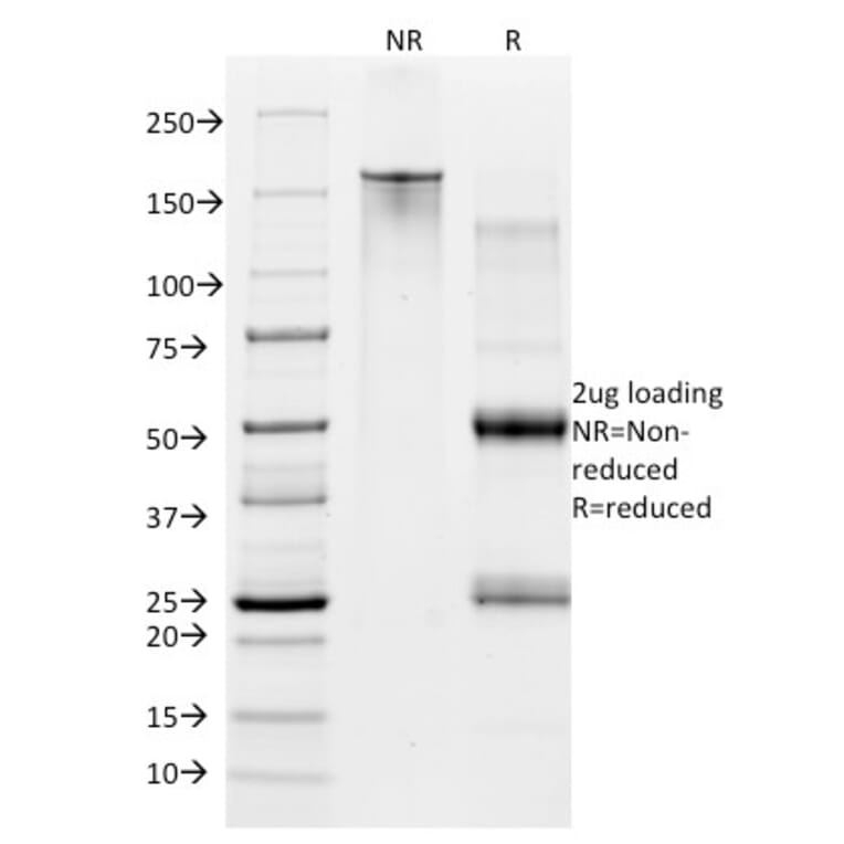 SDS-PAGE - Anti-CD28 Antibody [CB28] (PE) (A251156) - Antibodies.com